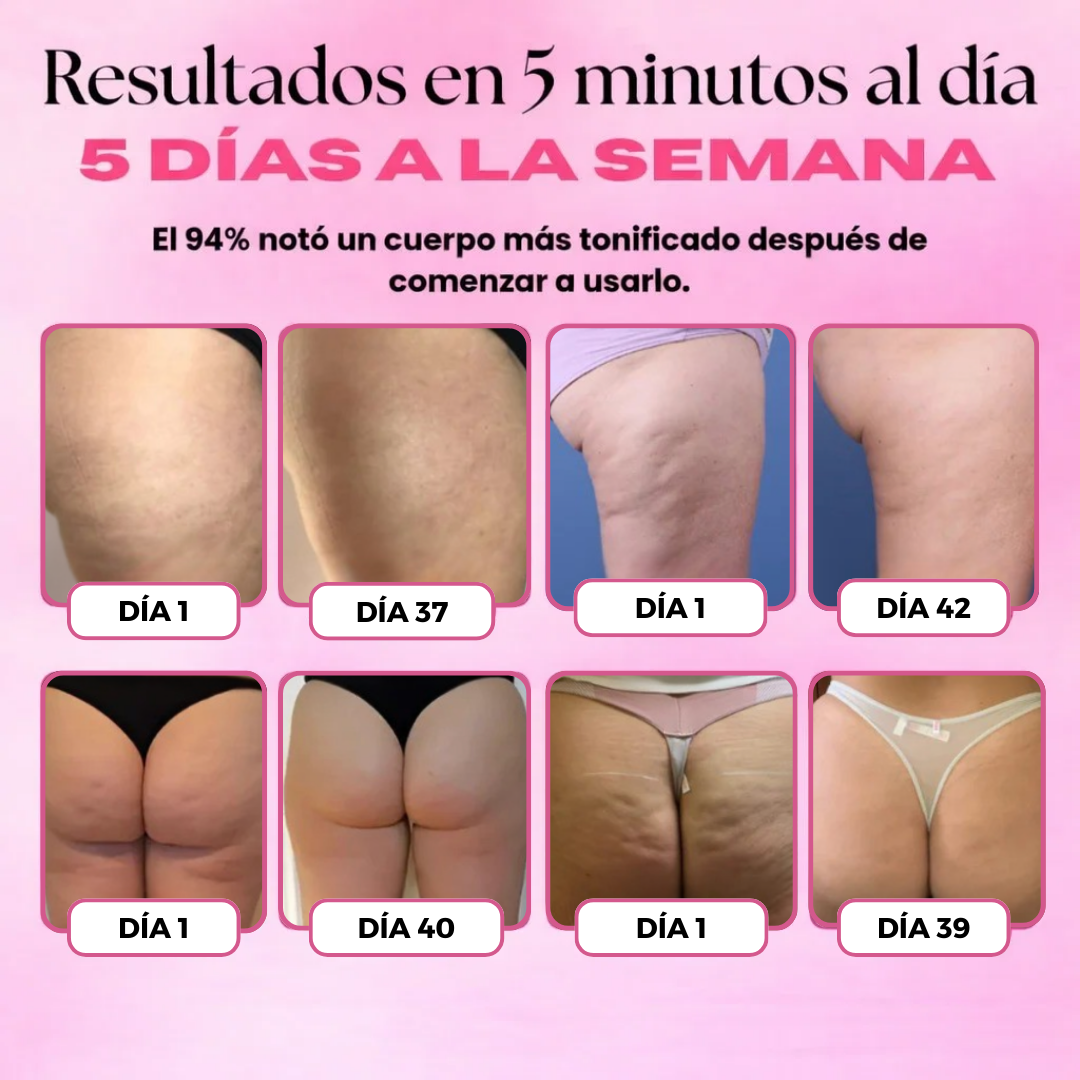 SheVitality™ | Tratamiento Anticelulitis